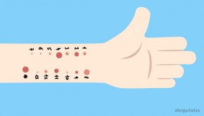 pruebas-alergia-prick-test-allergychef