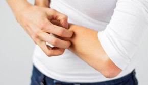 piel-atopica-alergia-alimentos-allergychef.jpg