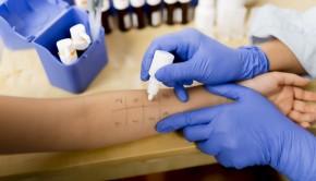alergia-alimentaria-adultos-desencadenantes-allergychef